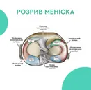 Фото компанії Травматолог-ортопед "КВАСНЮК ДМИТРО ІВАНОВИЧ"