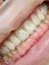 Фото компанії Implant D.Center лікаря Дацюк В.А.