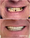 Фото компанії Dentix
