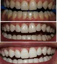 Фото компанії Dent me