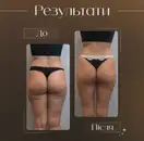 Фото компанії Beautifyl_skin