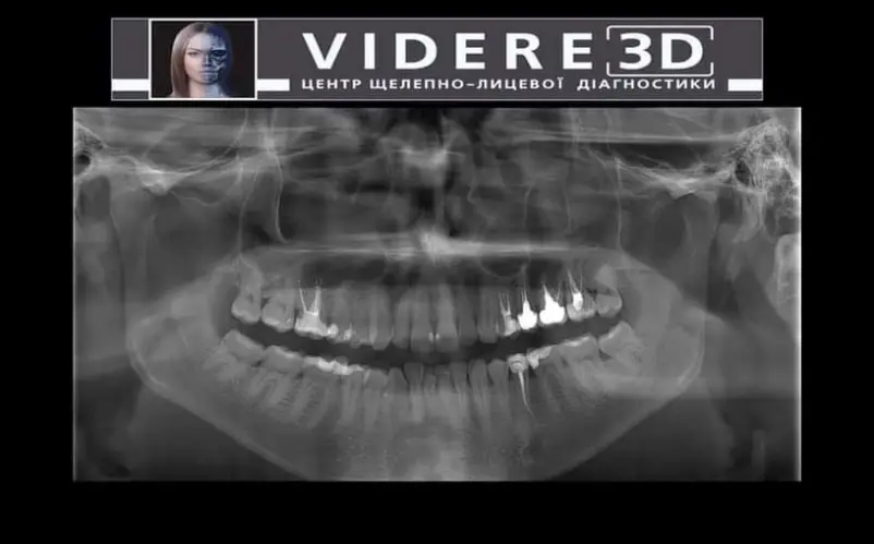 Фото компанії Центр щелепно-лицевої діагностики "Videre_3d"