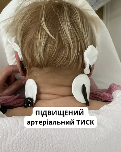 Фото компанії Гірудотерапія, оздоровлення пʼявкою медичною