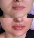 Фото компанії Yara Lips