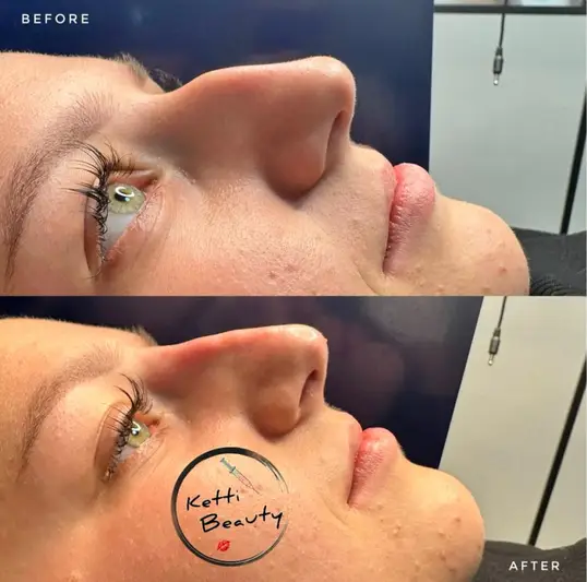 Фото компанії Cosmetologist Ketti