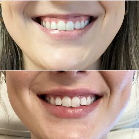 Фото компанії Стоматологія "DEVI DENTAL"