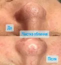 Фото компанії Естетична косметологія