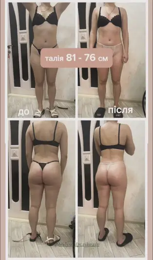 Фото компанії Bodysculpt.vika.vin
