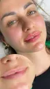 Фото компанії Косметологія "MARIANA.MOS.MEDICAL"