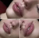 Фото компанії Yara Lips