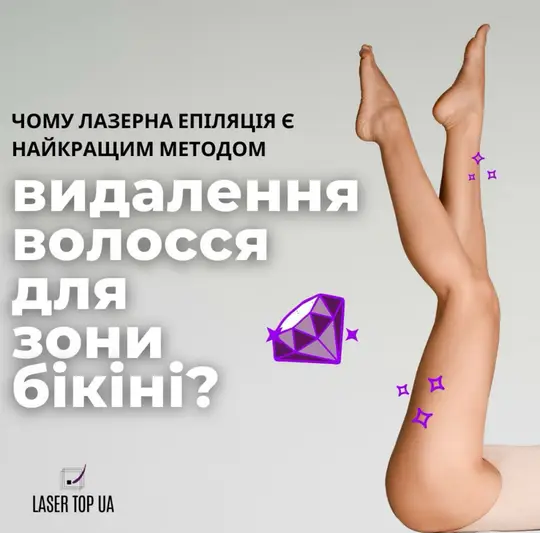 Фото компанії Laser Top Ua