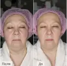 Фото компанії Косметолог "Ірина Тверда"