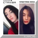 Фото компанії ТОВ "Клініка ЛОР ендоскопічної та пластичної хірургії Стах +