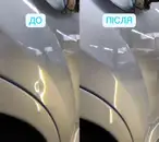 Фото компанії Центр видалення вм'ятин "Neon Dent"