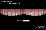 Фото компанії Естетична стоматологія
