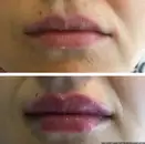Фото компанії Косметолог "Dr. Olga Marych antiage"