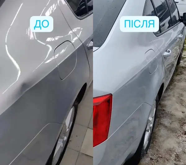 Фото компанії Центр видалення вм'ятин "Neon Dent"
