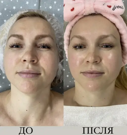 Фото компанії Milerystudio
