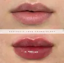 Фото компанії Aesthetic love