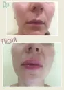 Фото компанії Дермато-косметологічний центр