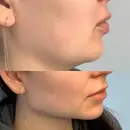 Фото компанії Косметолог "Lipslviv"