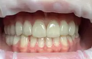 Фото компанії Implant D.Center лікаря Дацюк В.А.