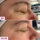 Фото компанії Косметологія "Beautymed"