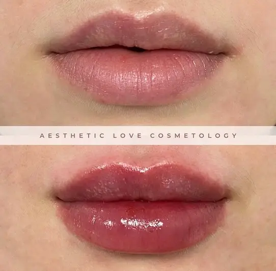 Фото компанії Aesthetic love