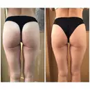 Фото компанії Natali_massage_if