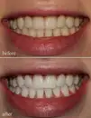 Фото компанії Dent me