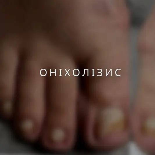 Фото компанії Майстер класичного педикюру "Наталія"