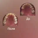 Фото компанії Стоматолог "Тетяна Попова"