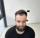 Фото компанії Al's Hair Clinic