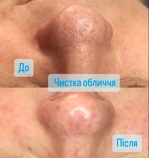 Фото компанії Естетична косметологія