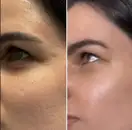 Фото компанії Центр косметології "Leonova Beauty Secret"