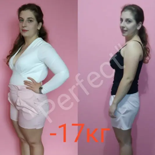 Фото компанії Клуб корекції фігури "Perfect"