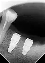 Фото компанії Стоматолог-хірург "Октисюк Андрій Васильович"