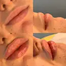 Фото компанії Косметолог "Lipslviv"